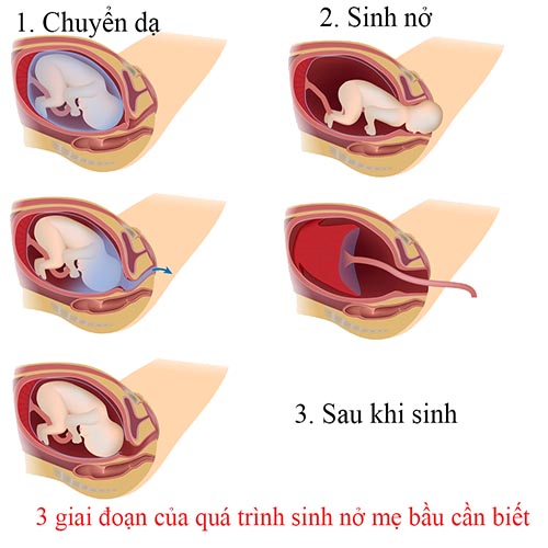 Quá trình sinh nở gồm mấy giai đoạn